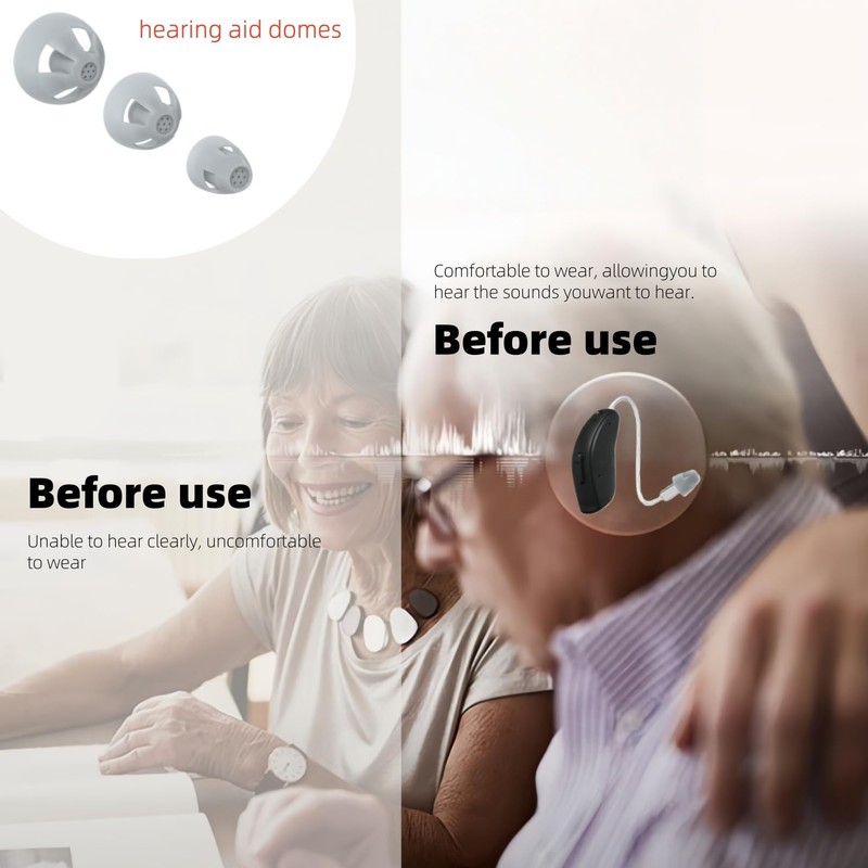 Resound Hearing aid Domes,GN Resound Hearing aid Domes Open,Resound Compatible