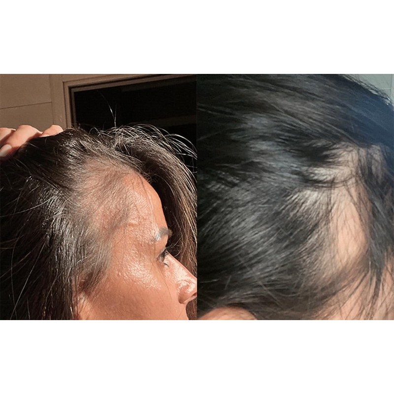 Anti Hair Loss Shampoo Tricostrong 200ml - With Tricofactor Growth