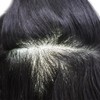 Hair Wonders Ultra Thin Skin Toupee For Men Hair Piece