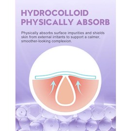 Parches para acne, 108 piezas, Estrellas para granos, 5 tamaños (8, 10, 12, 14, 16 mm), Hidrocoloides pimple patches que se adaptan con precisión a di