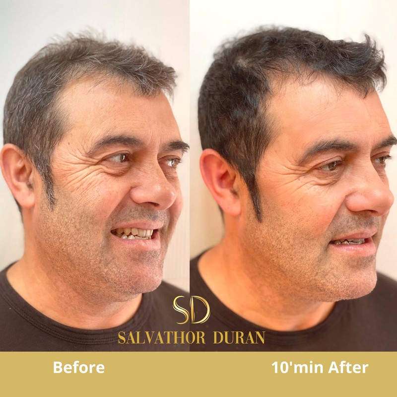 Mens Hair Dye Salvathor Duran - 20 Applications - Beard