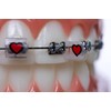 Snapcaps Braces Bumper Cover, Orthodontic Bracket Wax Substitute, Alternative Snap-on