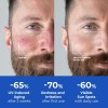 DIPSEVEN 6 in 1 Face Cream for Men: Anti-Aging Mens
