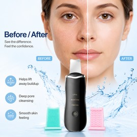 Ultrasonic Skin Scrubber for Face Cleansing – Heated Facial Spatula for Deep Pore Care at Home