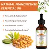 Frankincense Essential Oil 2Fl Oz, Frankincense Oil for Face, 100%