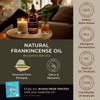 Gya Labs Frankincense Essential Oil - Huge 4 Fl Oz