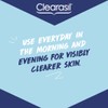Clearasil Rapid Action Pimple Cream 15ml