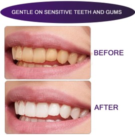 Purple Toothpaste for Teeth Whitening: Best Color-Correcting Toothpaste for Stain Removal, Sensitive Teeth Brightening & Non-Peroxide Whitening – for Adults, 1 fl oz (3 Pack, Package May Vary)