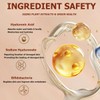 2Pcs Liquid Concealer Makeup, Eye Concealer, Full Coverage Concealer For