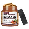 Aceite De Batana Para El Crecimiento Del Cabello, Cabello As