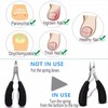 EZ Toenail Clippers Nail Cutters Professional Pedicure Paronychia Tools Manicure