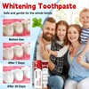 Sp-6 Probiotic Brightening Toothpaste, 2PCS 140g Super Probiotic SP-6 Whitening