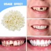 70PCS Temporary Tooth Crown,Temporary Crowns for Teeth,Tooth Repair Kit,Dental Temporary