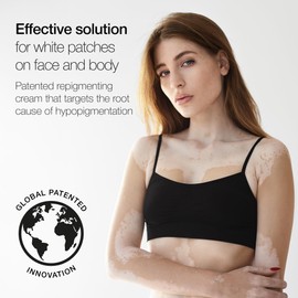 LULLAGE Repigment12 White Patches Corrector Cream for Dry Skin and Sensitive Skin, Paraben-Free Repigmentation Face and Body Cream for Women and Men, 2.5 Fl Oz