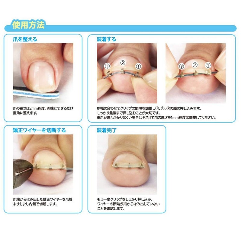 Winding Nail Lift with File (Crown Nail Lifts Set of