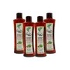 Tratamiento Shampoo Anticaída Árbol Verde 4pzs Romero Sábila