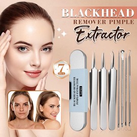 Kit de herramientas de extracción de puntos negros de grado médico, herramienta removedora de puntos negros, extractor de comedones, kit de eliminación de acné para imperfecciones - Popping - Juego de