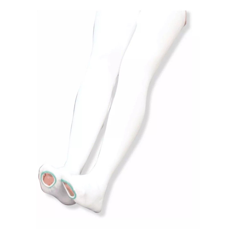 2 Medias Antiembólicas Muslo Alto/talla Mediana/envio Gratis