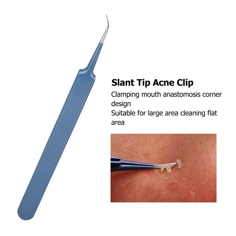 5pcs Blackhead Remover Professional Stainless Blue Acne Needle Tool Set