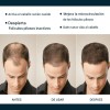 Pack de 3 Esencias Anticaída MOPOYAT para Hombre con Extra