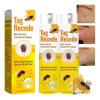 Crema Antipigmentaria Para Eliminar Las Verrugas Del Herpes,