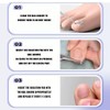 TSUOUKLSet zur Korrektur eingewachsener Zehennägel - 40 Stück schmerzfreie Zehennagelglättungsstreifen