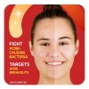 Asepxia Crema Para El Tratamiento Del Acné Para La Cara,