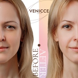 Venicce Love Slip-on Eyelids Stripes Invisible Eyelid Tightening without Surgery, Eyelid Tape, Natural Strips for Radiant Eyes, Eyelid Stripes - Skin-Friendly & Effective Against Slip-on Lids (L) Pack