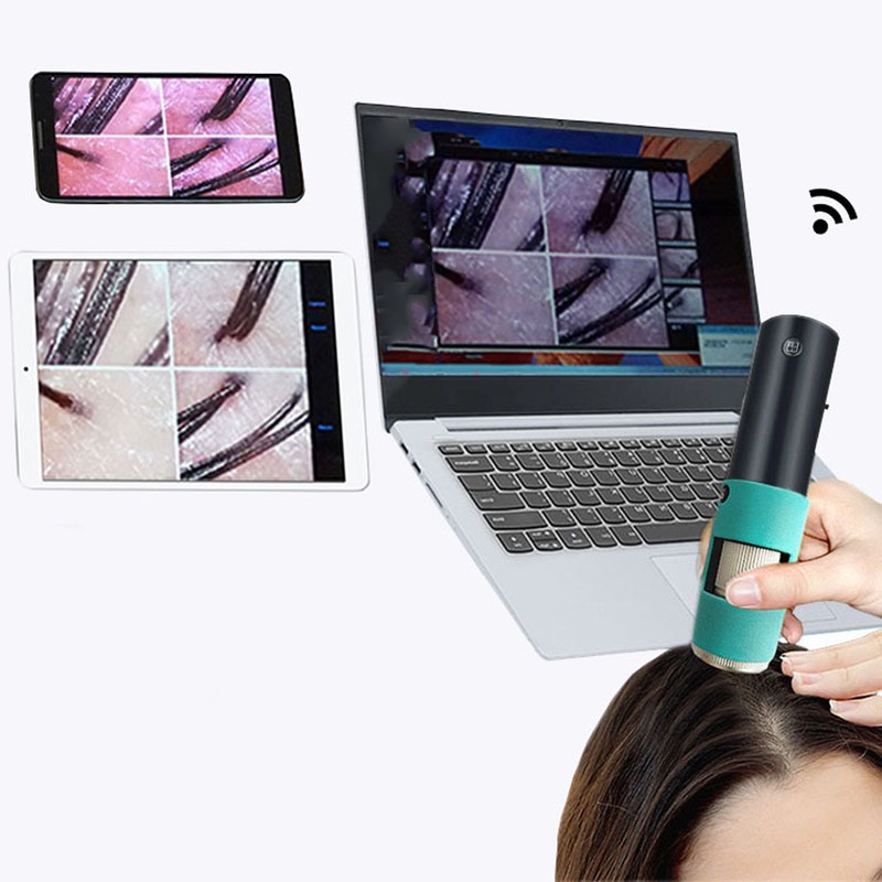 3MP Scalp Detector Portable Wireless Skin Dignosis WiFi Detector Handheld
