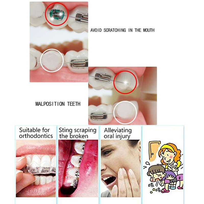 ieron Braces Wax Braces Braces Braces Wax with Fruit Odour