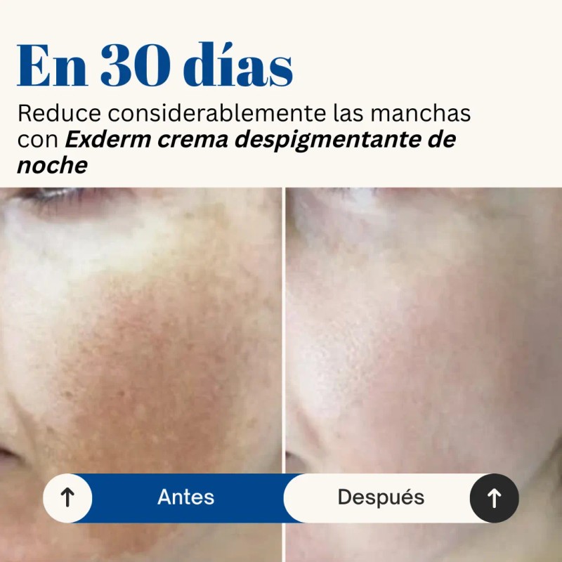 Exderm White Crema Despigmentante Intensiva De Noche 30 Ml Tipo