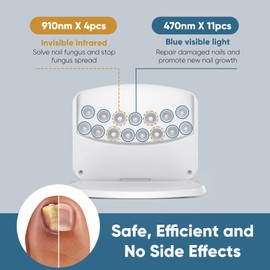 Nail Fungus Laser Device, Berrlly Nail Fungus Cleaning Device for Multiple Nails and Toenails with Selectable Time, Adjustable Height to Avoid Squeezing Nails(White)