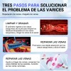 Crema Para Varices Alivio Y Mejora De La Circulación 20g