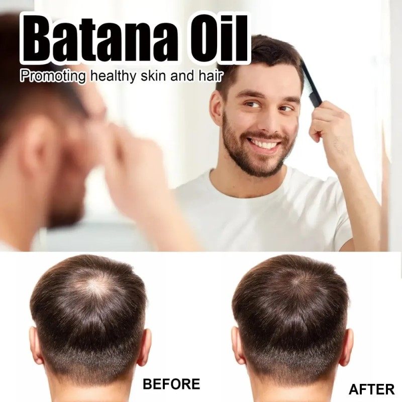/ Aceite De Batana, Aceite De Batana Orgánico For Un
