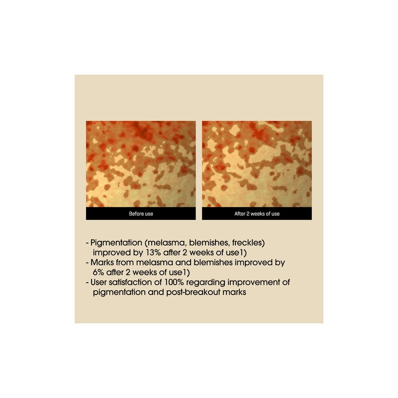SOME BY MI [SOME BY MI]*renewal* Yuja Niacin Anti-Blemish Serum