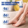 60% Urea Foot Cream for Cracked Heels & Dry Skin,