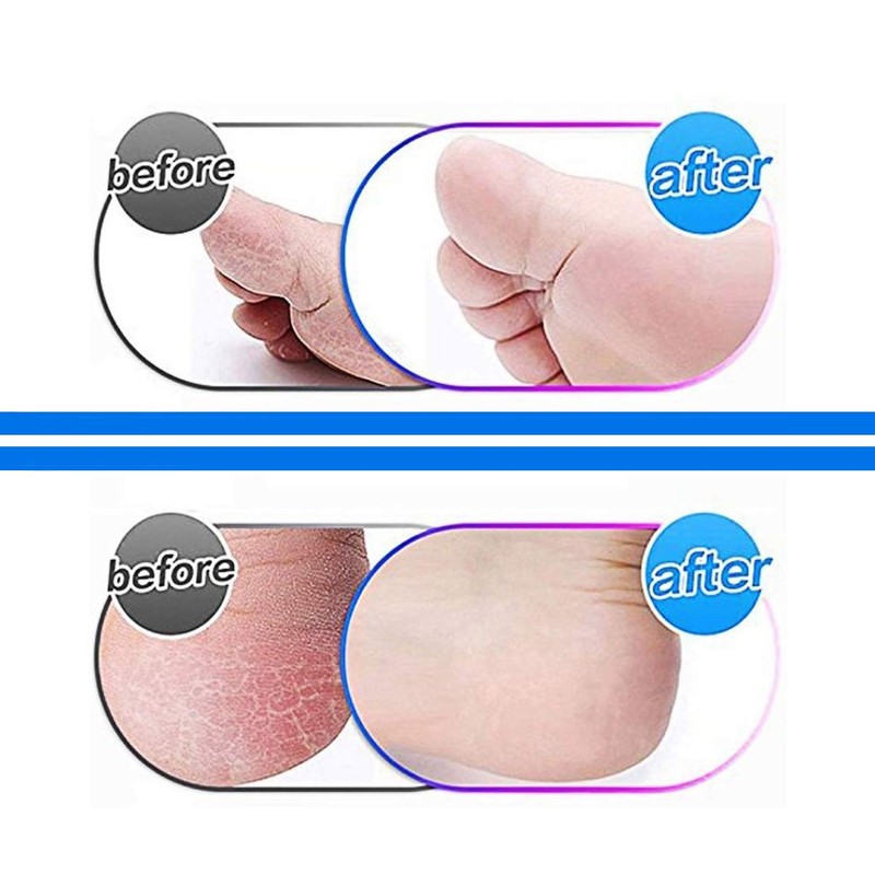 Itian 4er-Pack Ersatzrollen für Emjoi Micro Pedi Elektrisch Hornhautentferner, Mineral