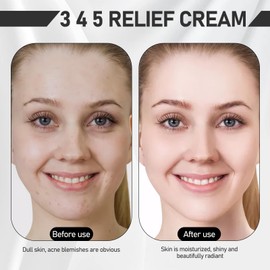 345 Relief Cream, Moisturising Cream Repair Cream for the Face for Acne and Oily Skin, Deep Moisturising Face Cream, Soothing Facial Moisturiser, Gentle Nourishing, Pack of 2