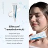 DR.Melaxin TX Tranexamic Acid CREAM | Skin freckle Cream, Blemishes,