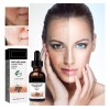 Deuiosna 2023 Corrección De Melanina Suero Facial, Sero De Cara