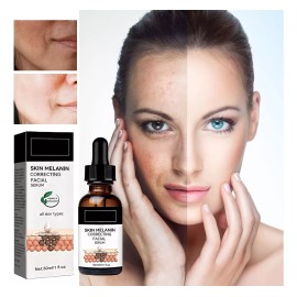 Deuiosna 2023 Corrección De Melanina Suero Facial, Sero De Cara Diari
