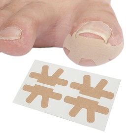 Zanchara Ingrown Toenail Treatment, 20Pcs Breathable Ingrown Toenail Strips,Painless Ingrown Toenail Tool for Nail Removal & Care, At-Home Pedicure Solution (Shape B)