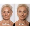Retinol + Collagen, Hyaluronic Acid, Vitamin C AntiAging Wrinkle Serum