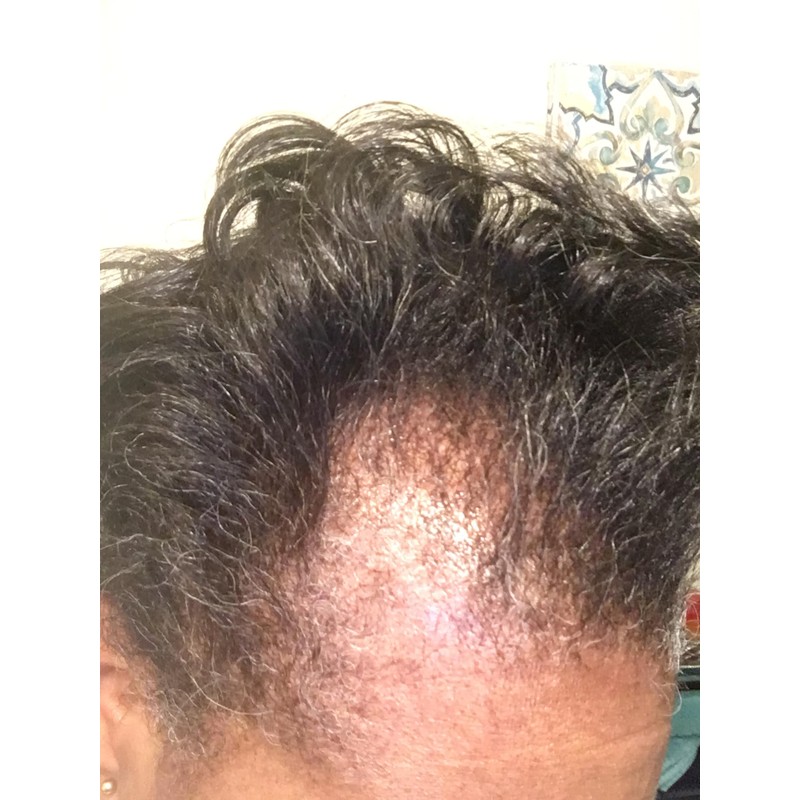 Kreyol Essence - Haitian Black Castor Oil for Skin and