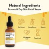 ECZEMA HONEY 15% Vitamin C + Ferulic Acid Serum -