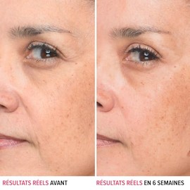 It Cosmetics Bye bye lines, Serum, Suero con Ácido Hialurónico, Reafirma Visiblemente la Piel y Suaviza las Líneas en 2 Semanas, Con Péptido + Vitamina B5, 30 ml