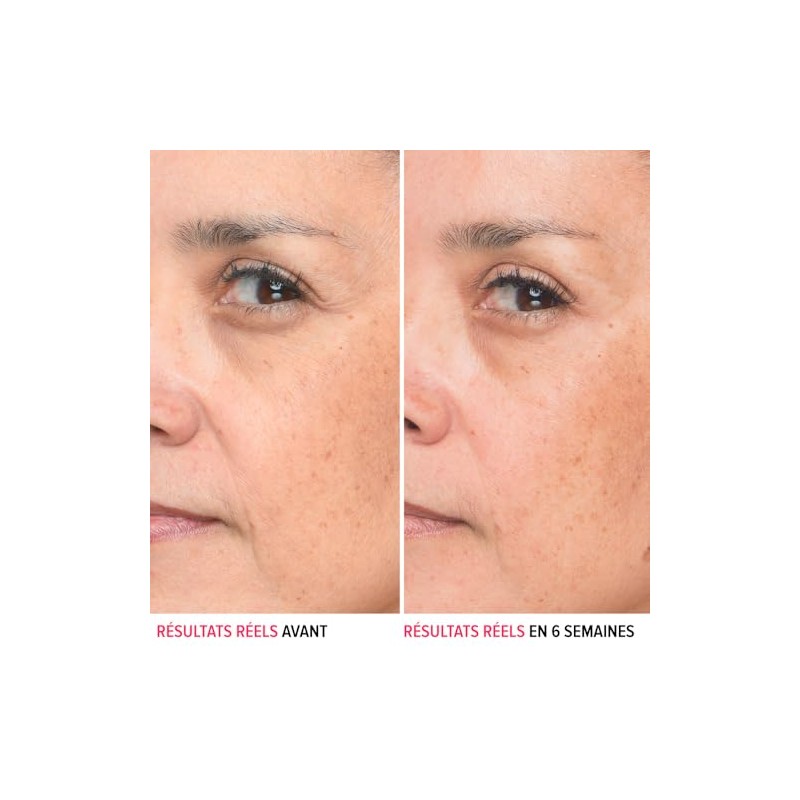 It Cosmetics Bye bye lines, Serum, Suero con Ácido Hialurónico,