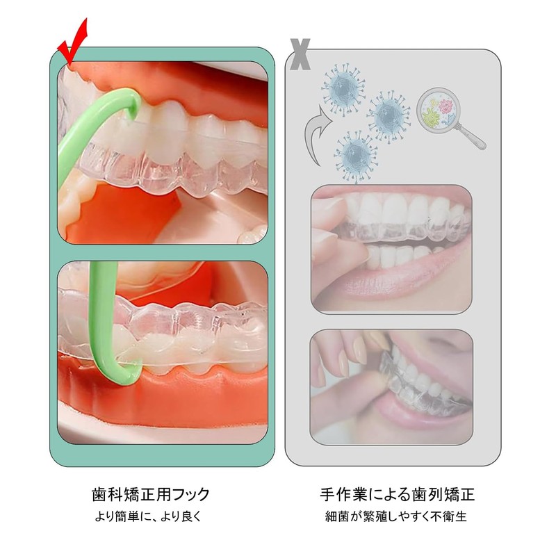 TerraShine Orthodontic Hooks Aligner Remover Removal Retainer Colorful Orthodontic Orthodontics