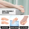 Kecartu 4 PCS Bunion Correctors for Women Men Big Toe,