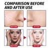3pcs Fruit Acid Serum 30ml Firming Skin Herbal Extract Oil